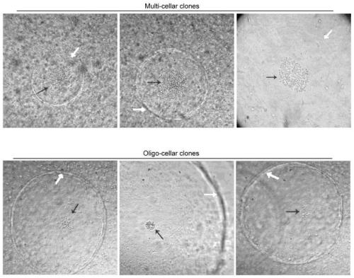 A method for establishing a liver cancer xenograft tumor model based on the hanging drop culture method of circulating tumor cells in liver cancer