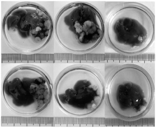 A method for establishing a liver cancer xenograft tumor model based on the hanging drop culture method of circulating tumor cells in liver cancer