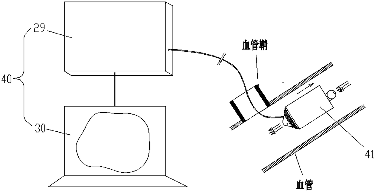 3D printing intravascular stenet conveyor