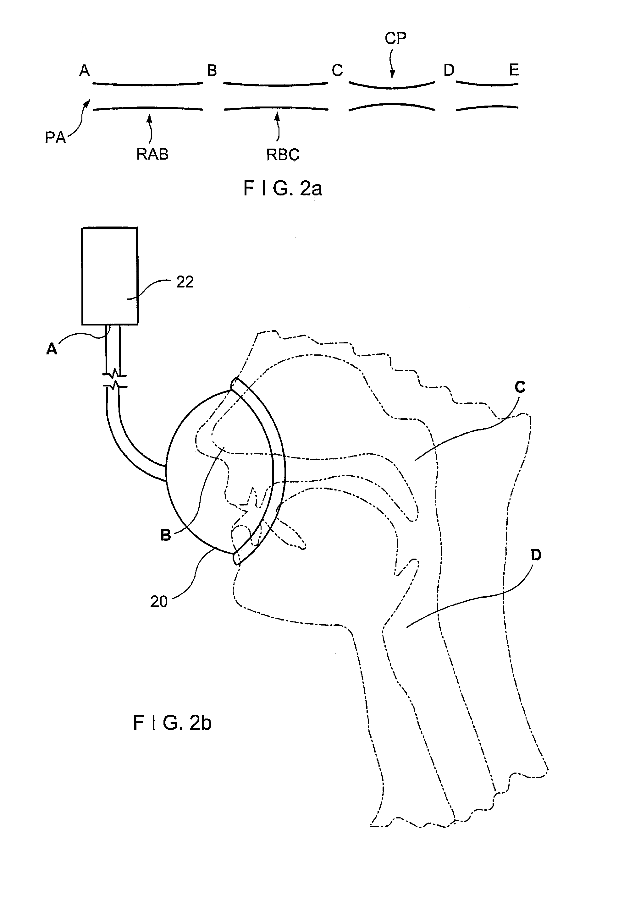 System and Method for Improved Treatment of Sleeping Disorders using Therapeutic Positive Airway Pressure