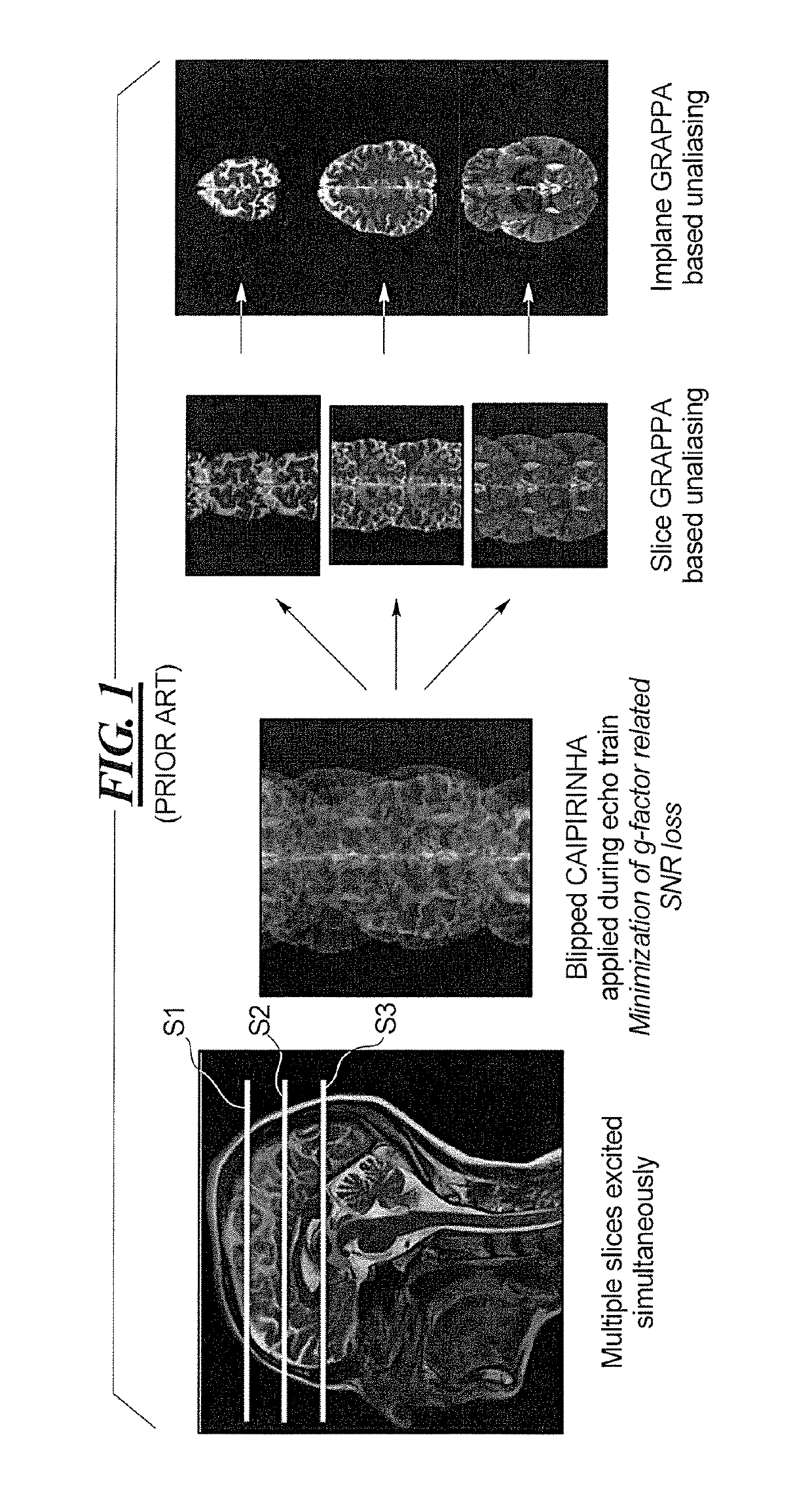 Multi-contrast simultaneous multislice magnetic resonance imaging with binomial radio-frequency pulses