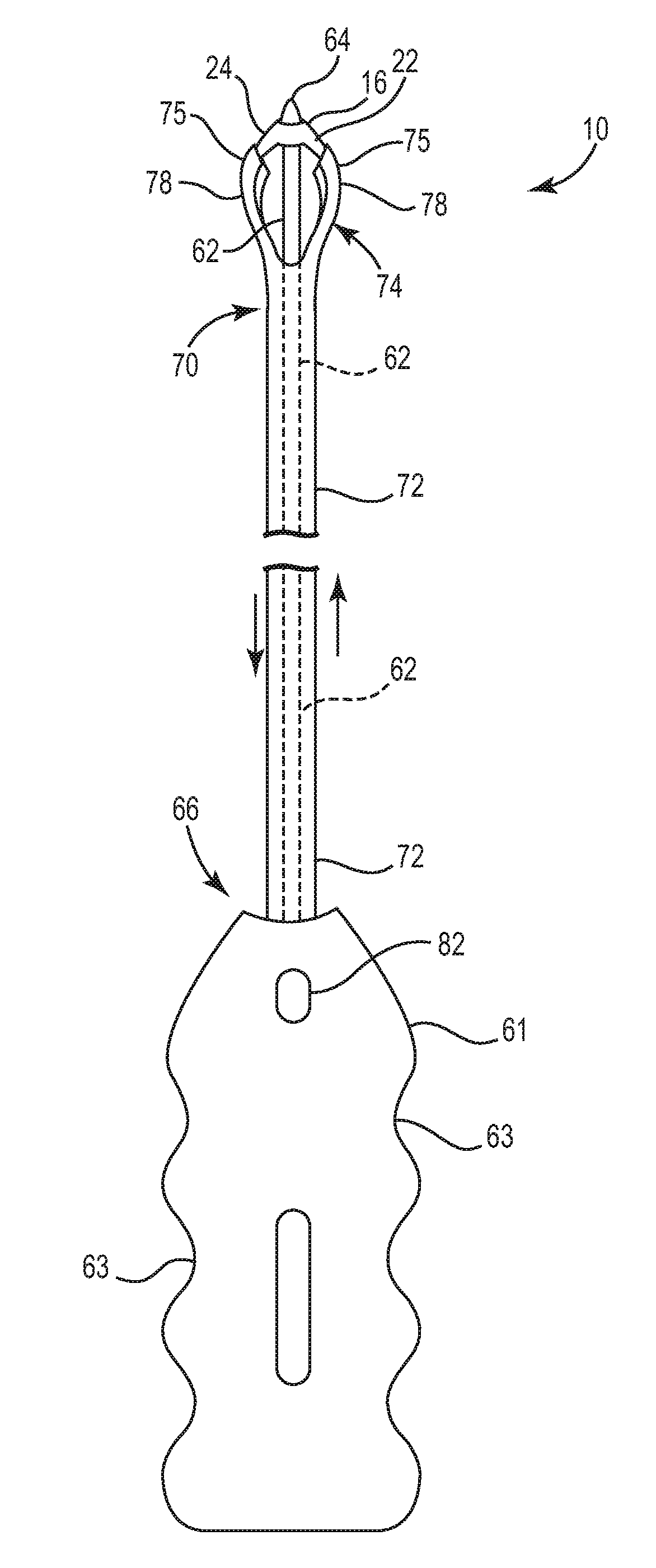 Pelvic implant and delivery system