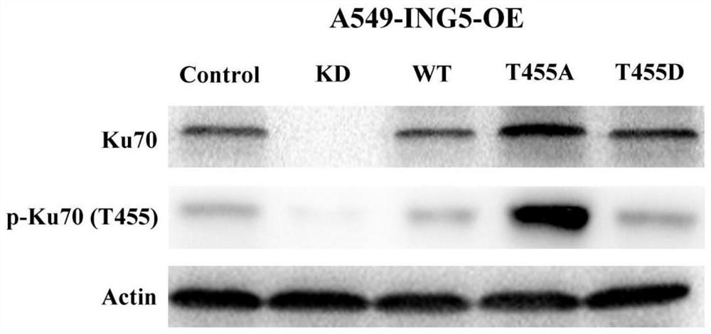 Ku70 protein T455 site phosphorylation inhibitor and application thereof