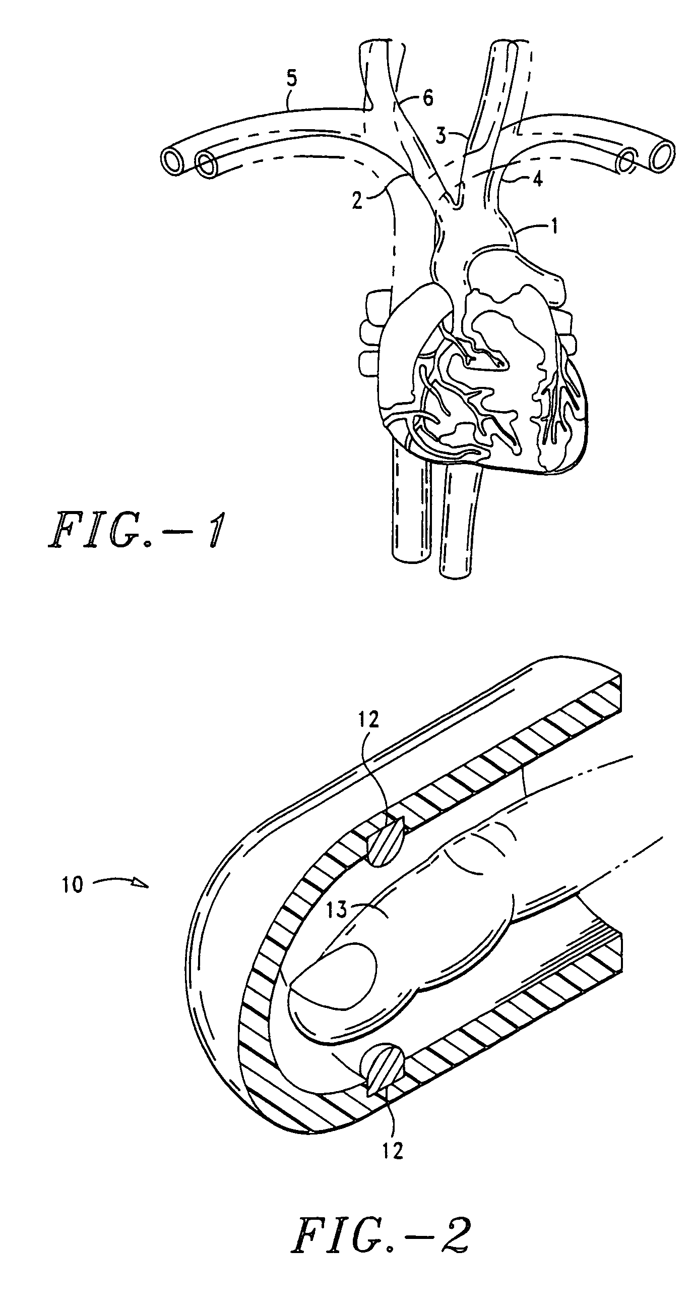Method for noninvasive continuous determination of physiologic characteristics
