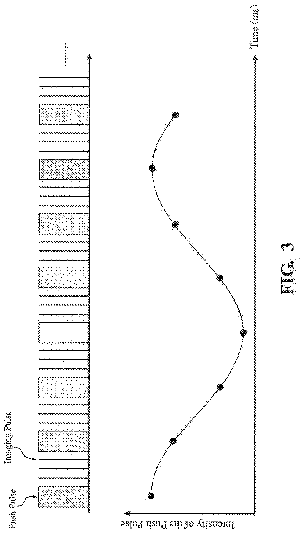 Harmonic shear wave imaging