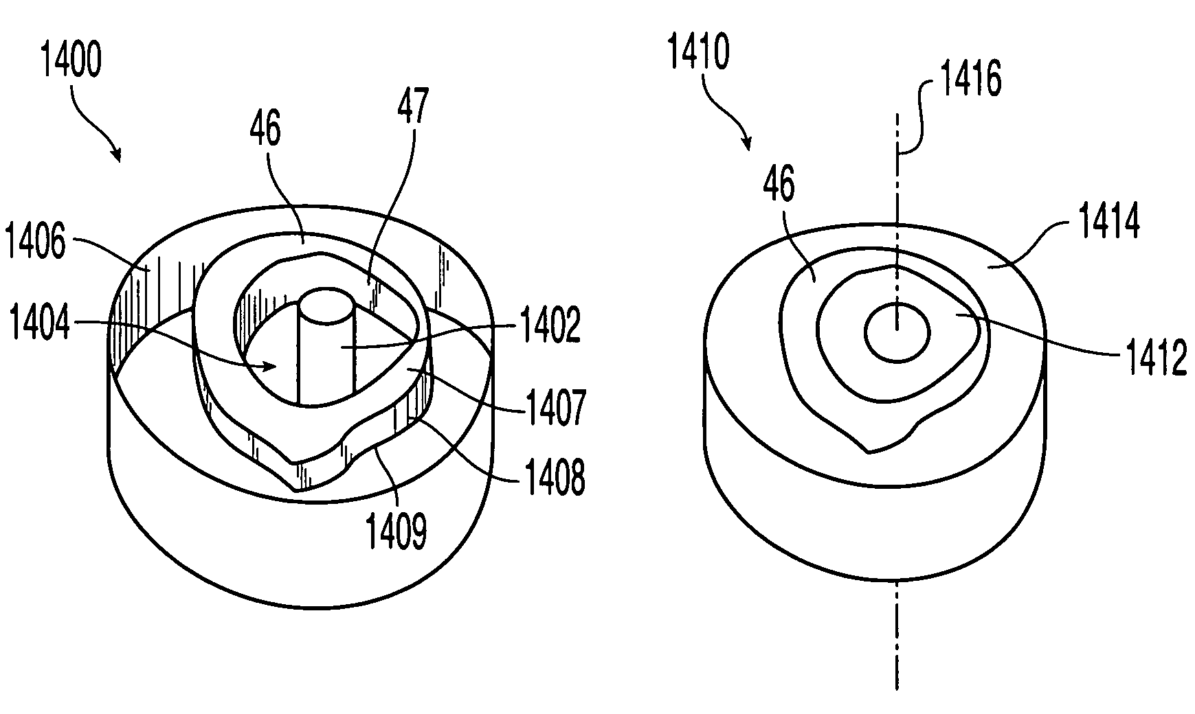 Implants formed of coupled bone