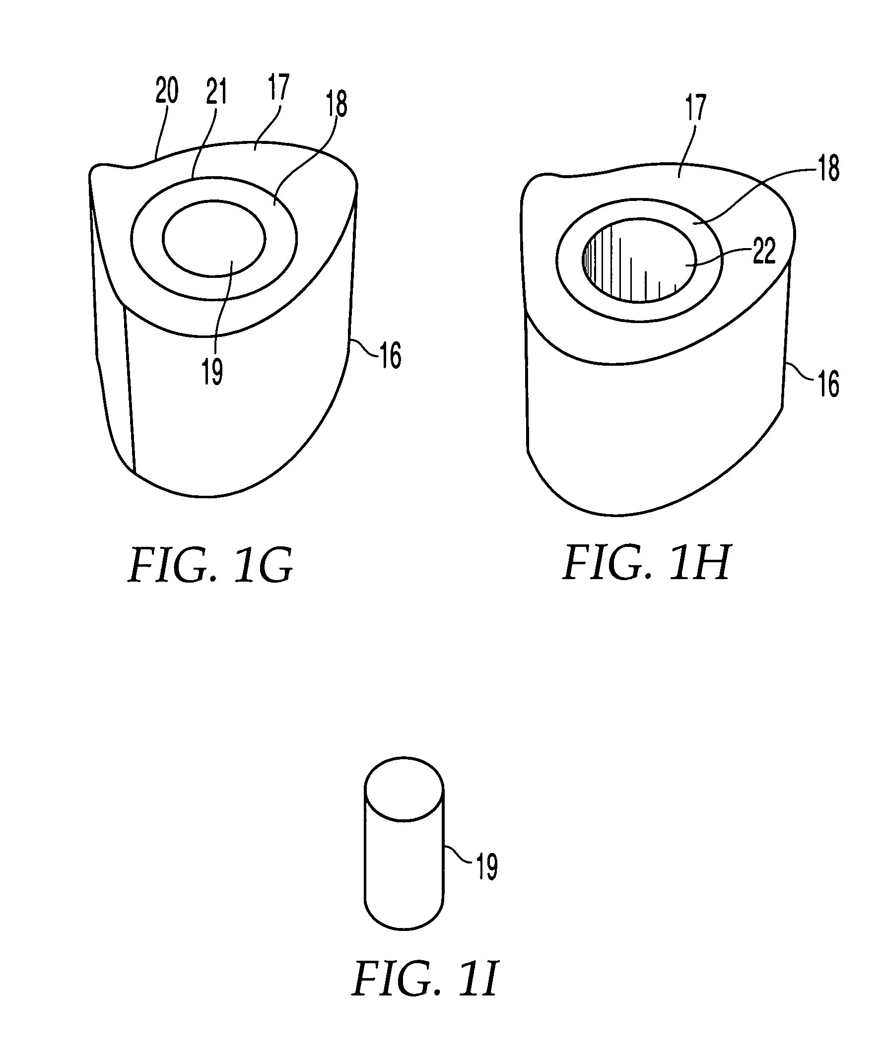 Implants formed of coupled bone