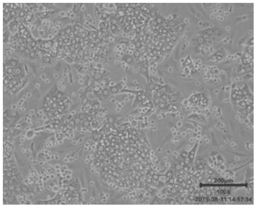 Separating and extracting method for primary liver parenchyma cells and application of primary liver parenchyma cells