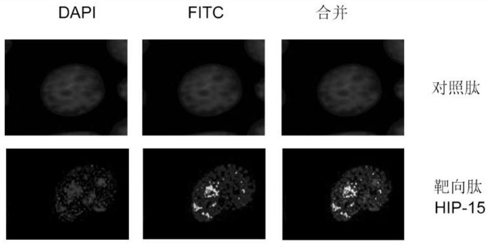 Polypeptide HIP-15 capable of antagonizing hnRNPK protein RNA binding activity and application thereof