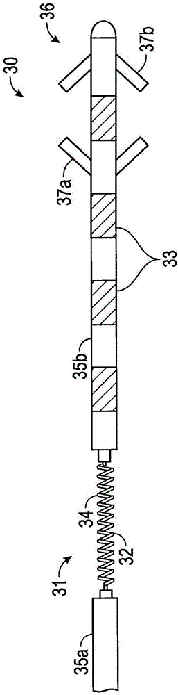 Electrode leads for use with implantable neuromuscular electrical stimulator