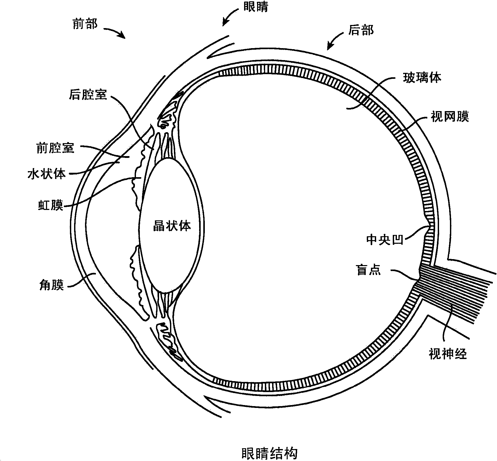 Implantable ophthalmic MEMS sensor devices and methods for eye surgery