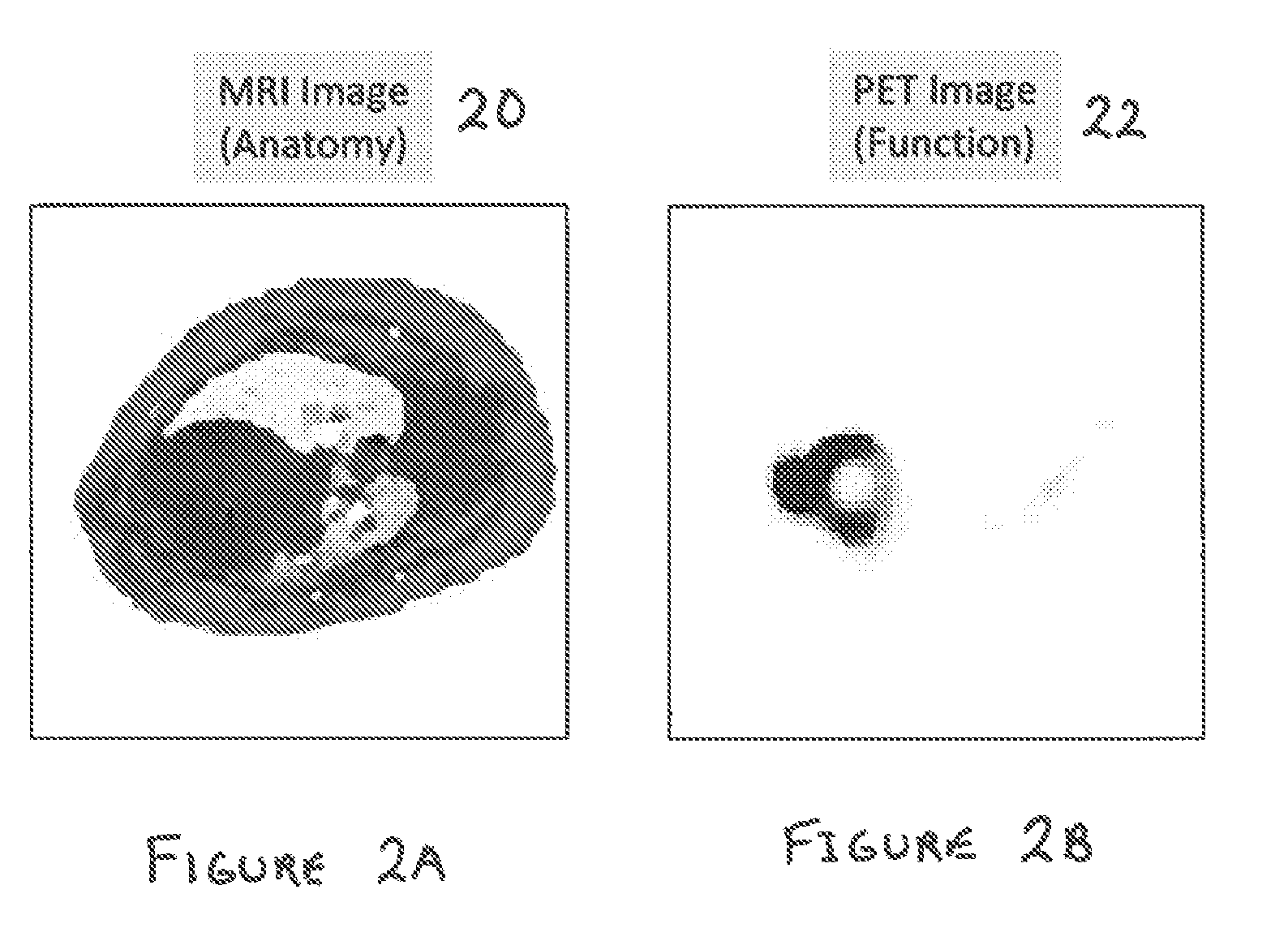 System and method for correcting attenuation in hybrid medical imaging