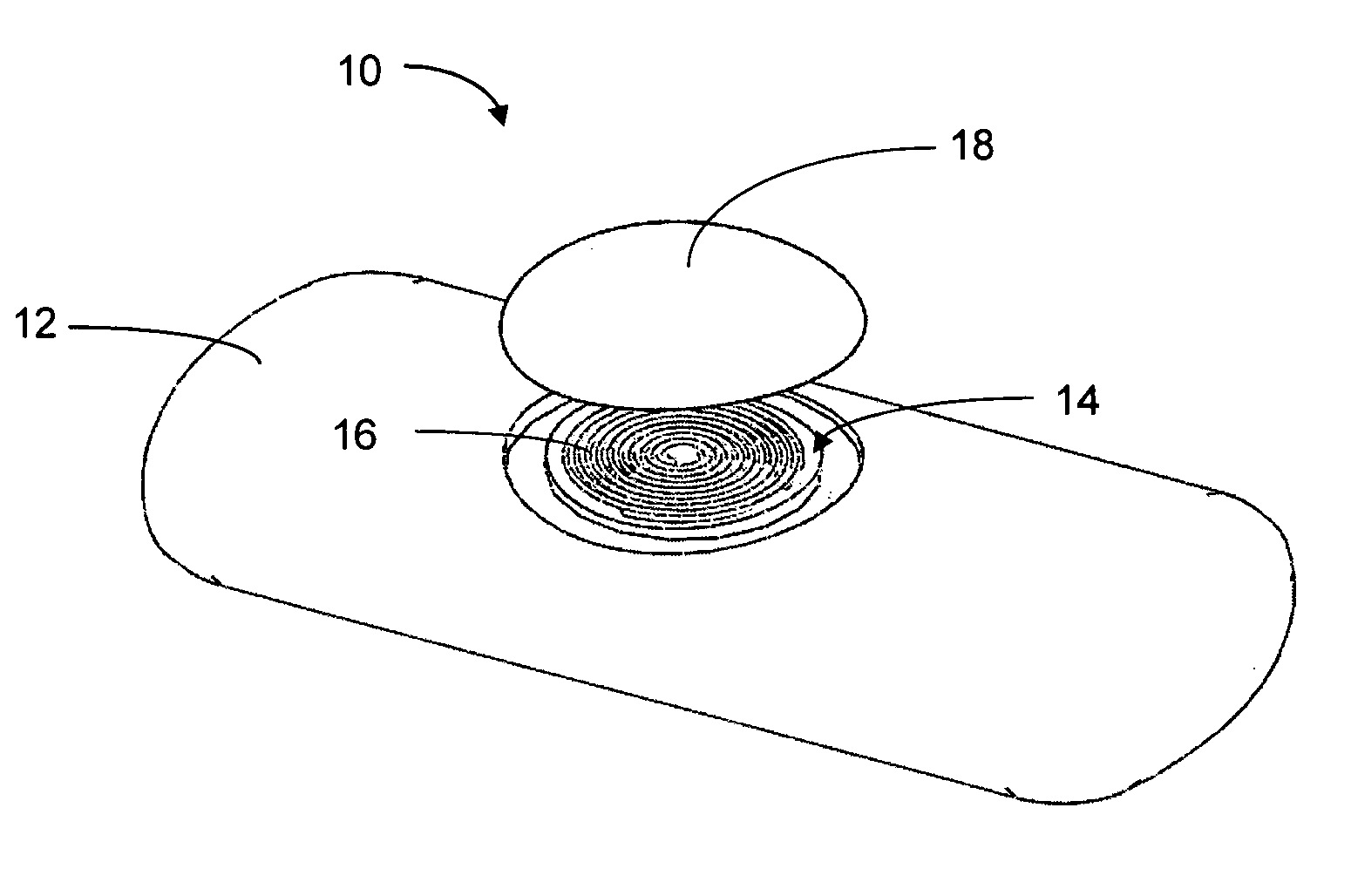 Rolled electrode array and its method for manufacture