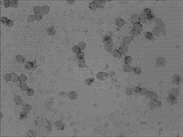 Various early-stage cancer pathology evolution MICRORNA-16 level in situ hybridization detection kit, detection method thereof and application thereof