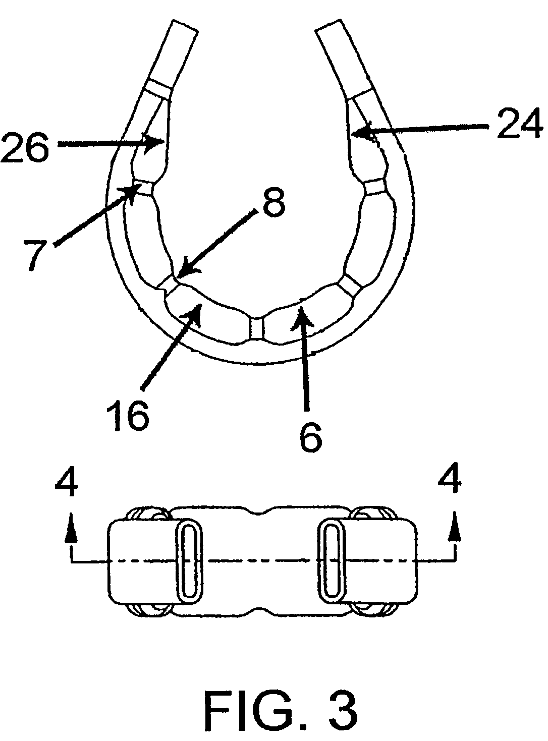 Fatigue-resistant gastric banding device