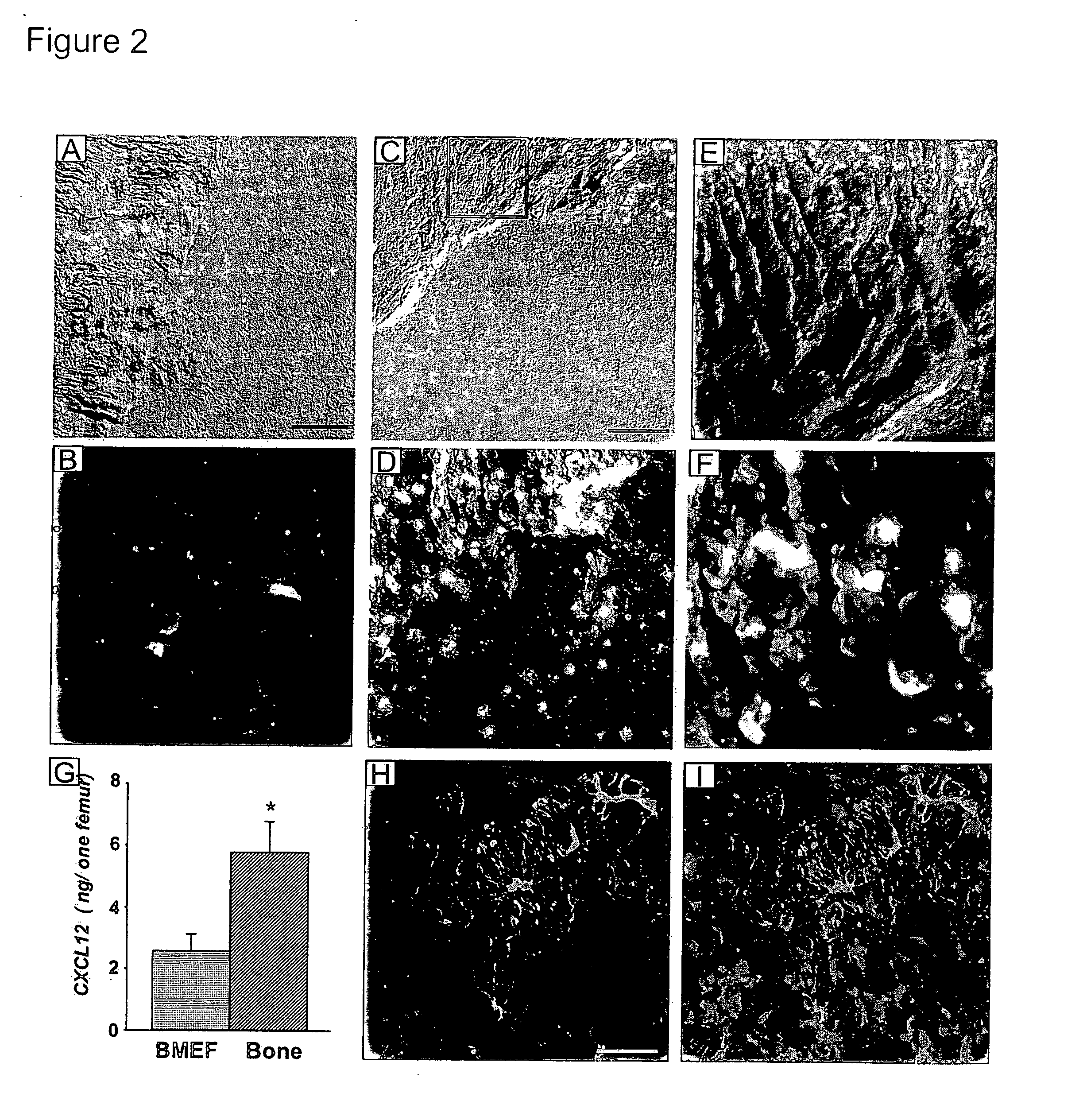 Methods and compositions for modulating the mobilization of stem cells