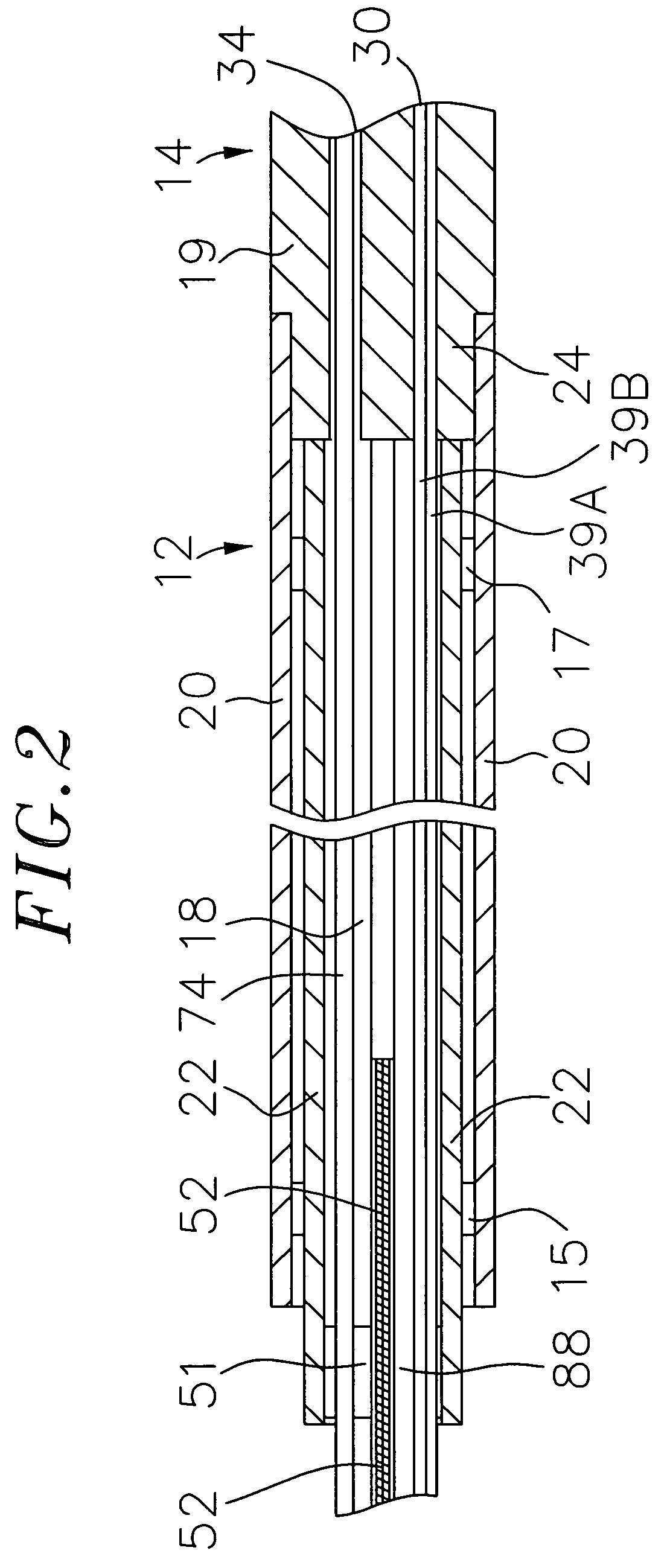 System and method for selectively energizing catheter electrodes