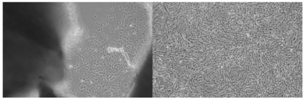 Culture method of hair follicle mesenchymal stem cells