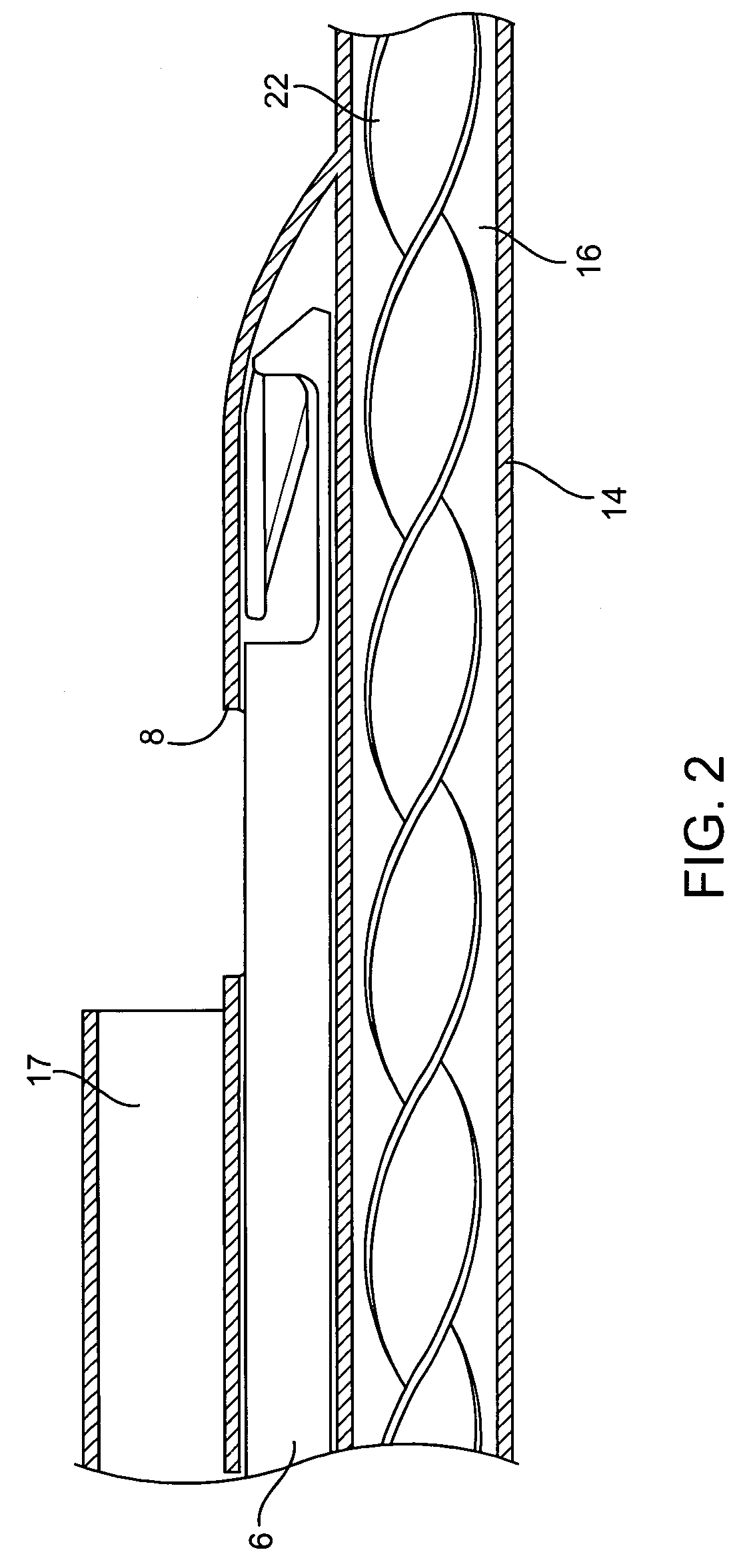 Methods and devices for improving the appearance of tissue
