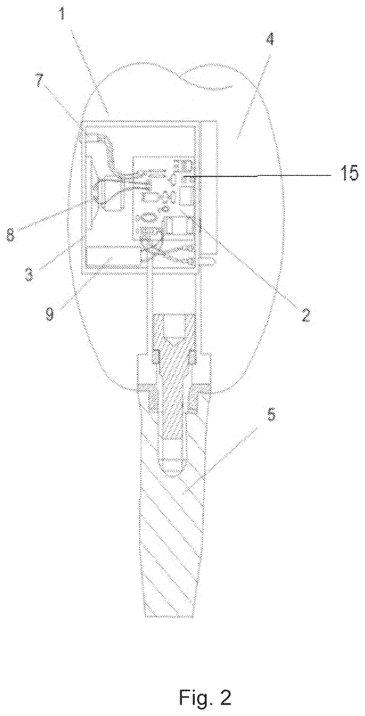 Intraoral device