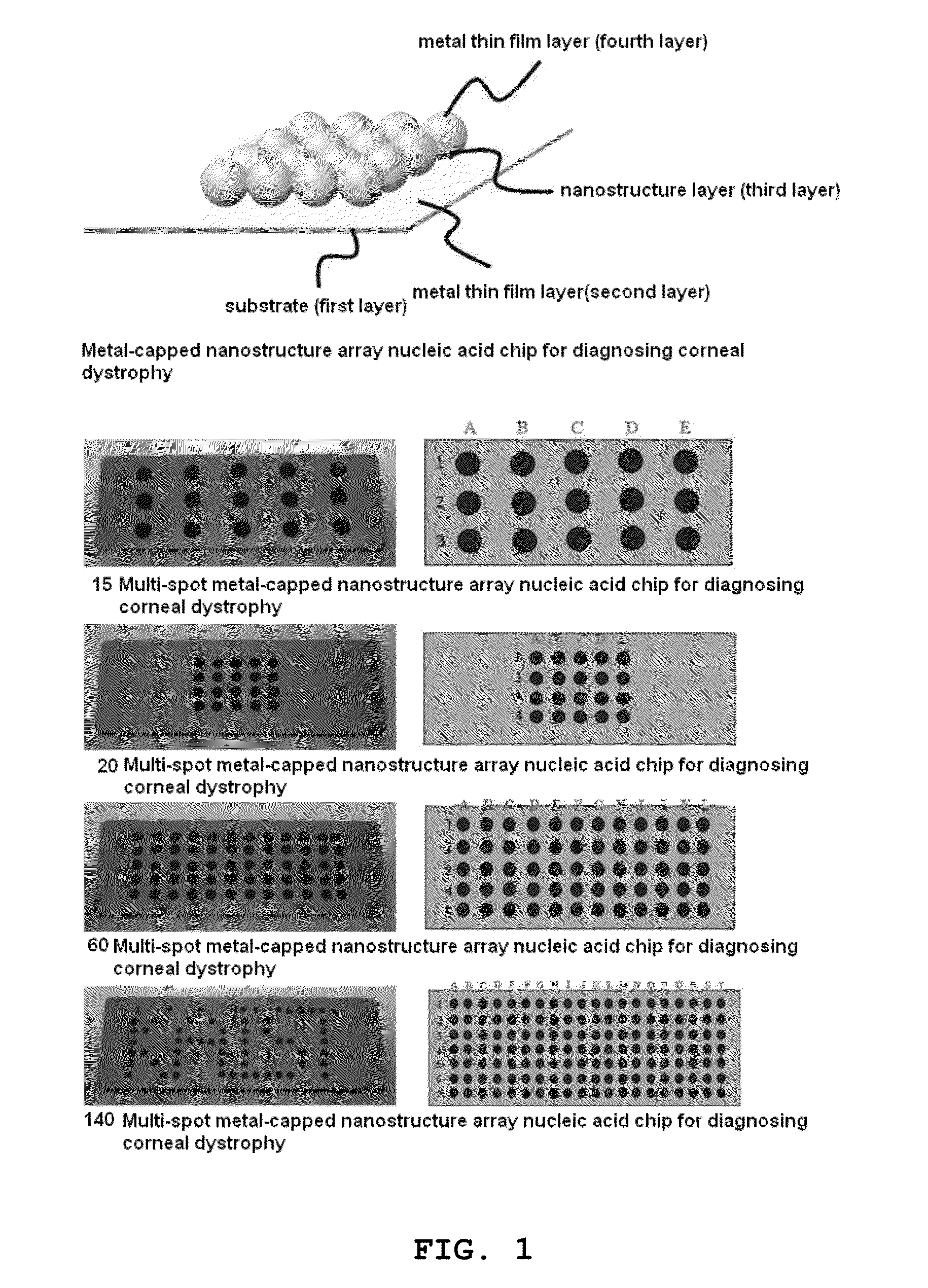 Multi-spot metal-capped nanostructure array nucleic acid chip for diagnosis of corneal dystrophy and preparation method thereof