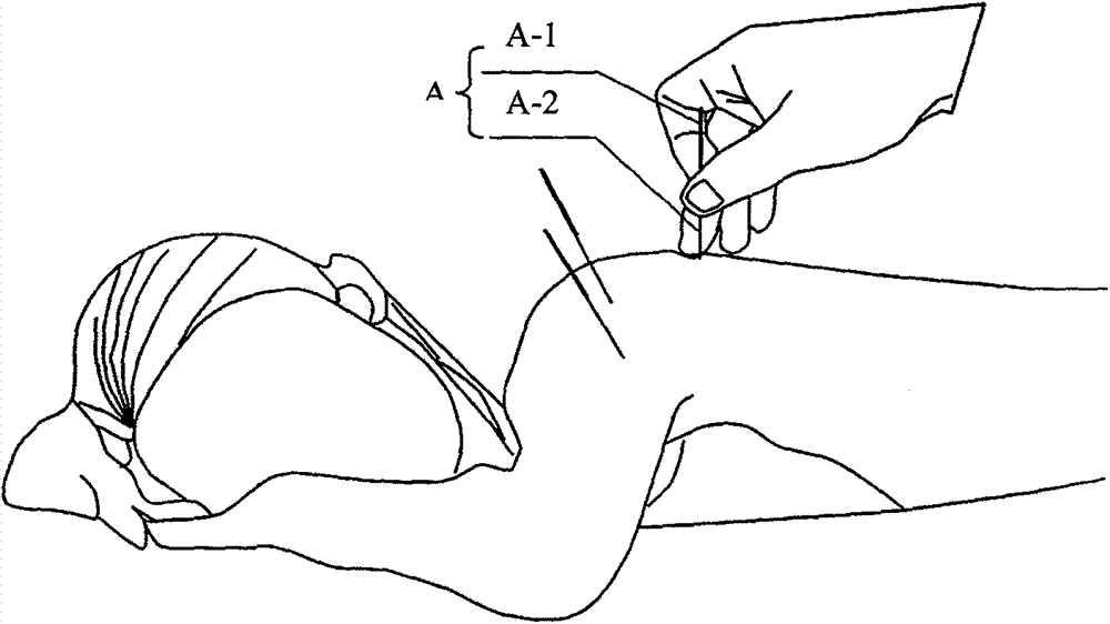 Acupuncture assisting device