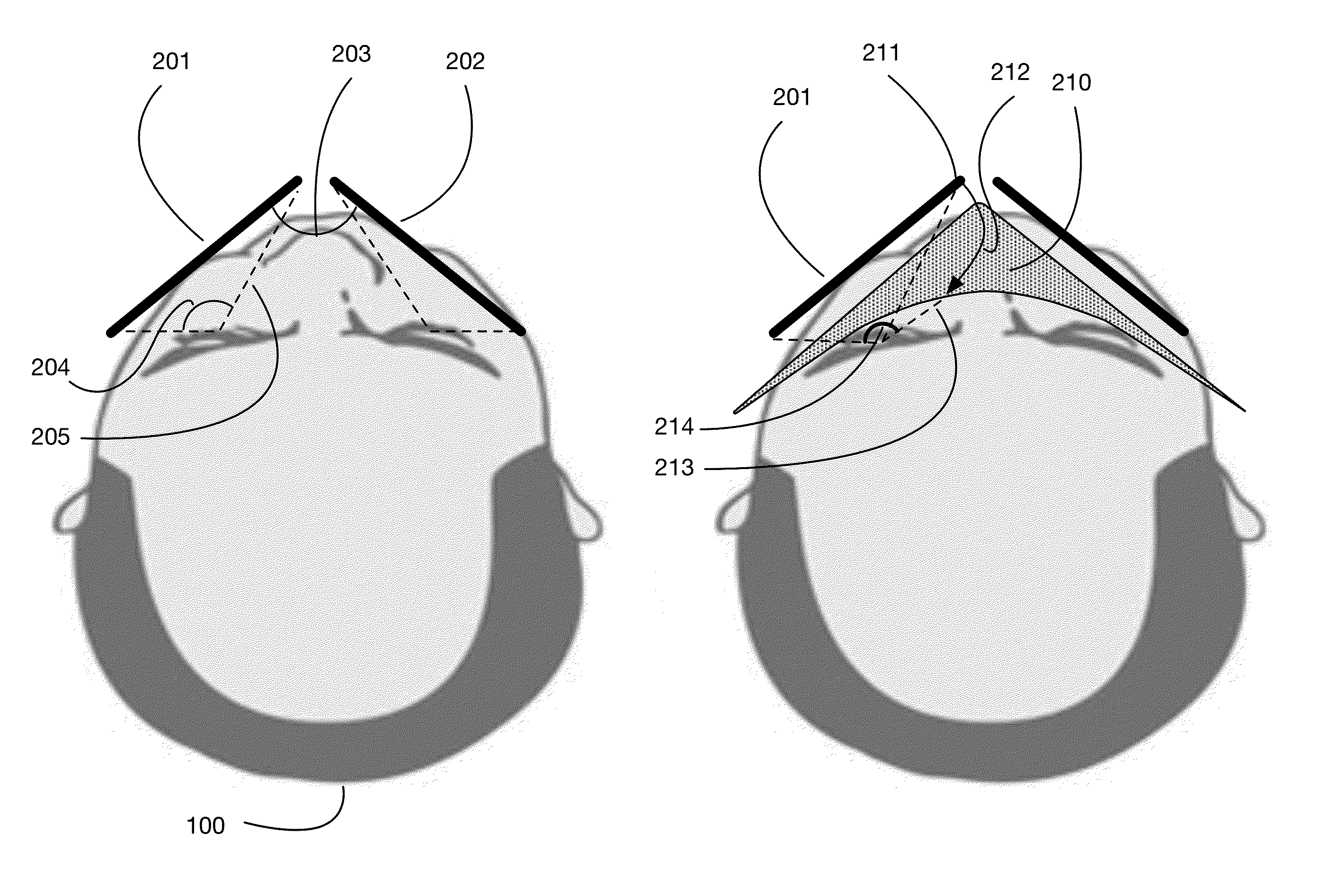 Wide field-of-view head mounted display system