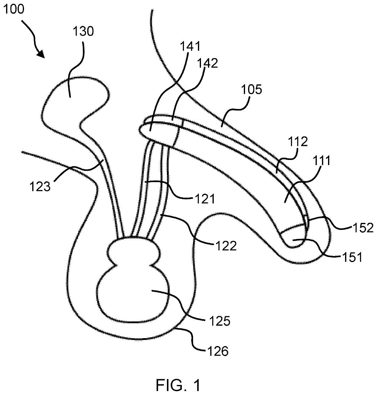 Penile prosthesis comprising a reservoir attachable to a pump by connectors
