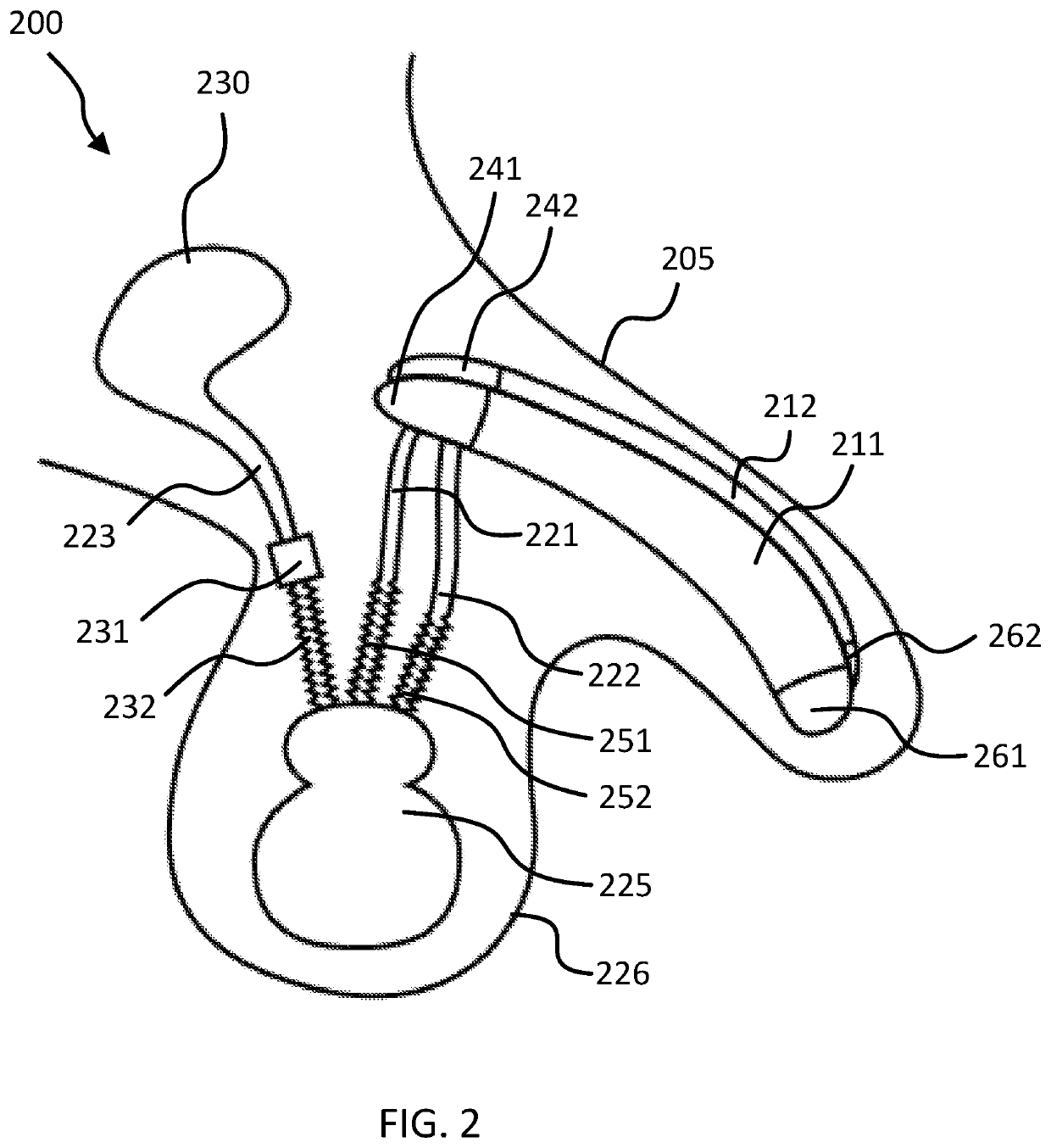 Penile prosthesis comprising a reservoir attachable to a pump by connectors