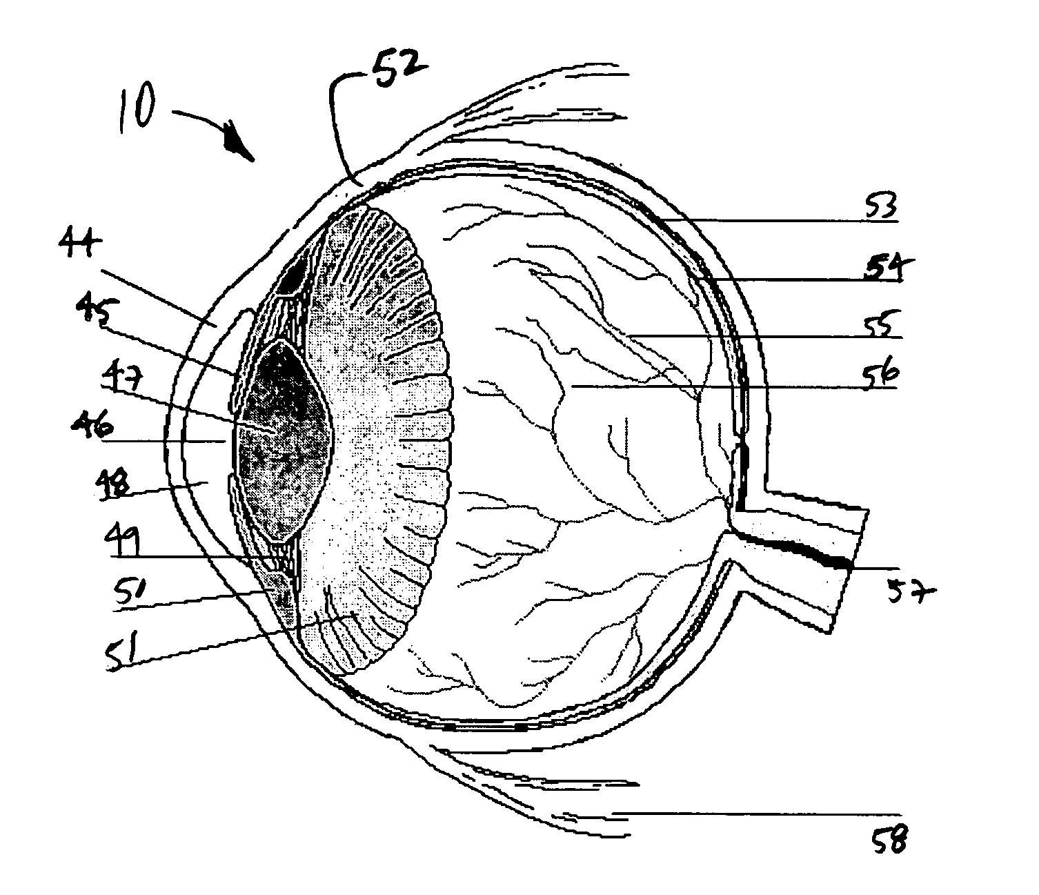Device for the irradiation of the ciliary body of the eye