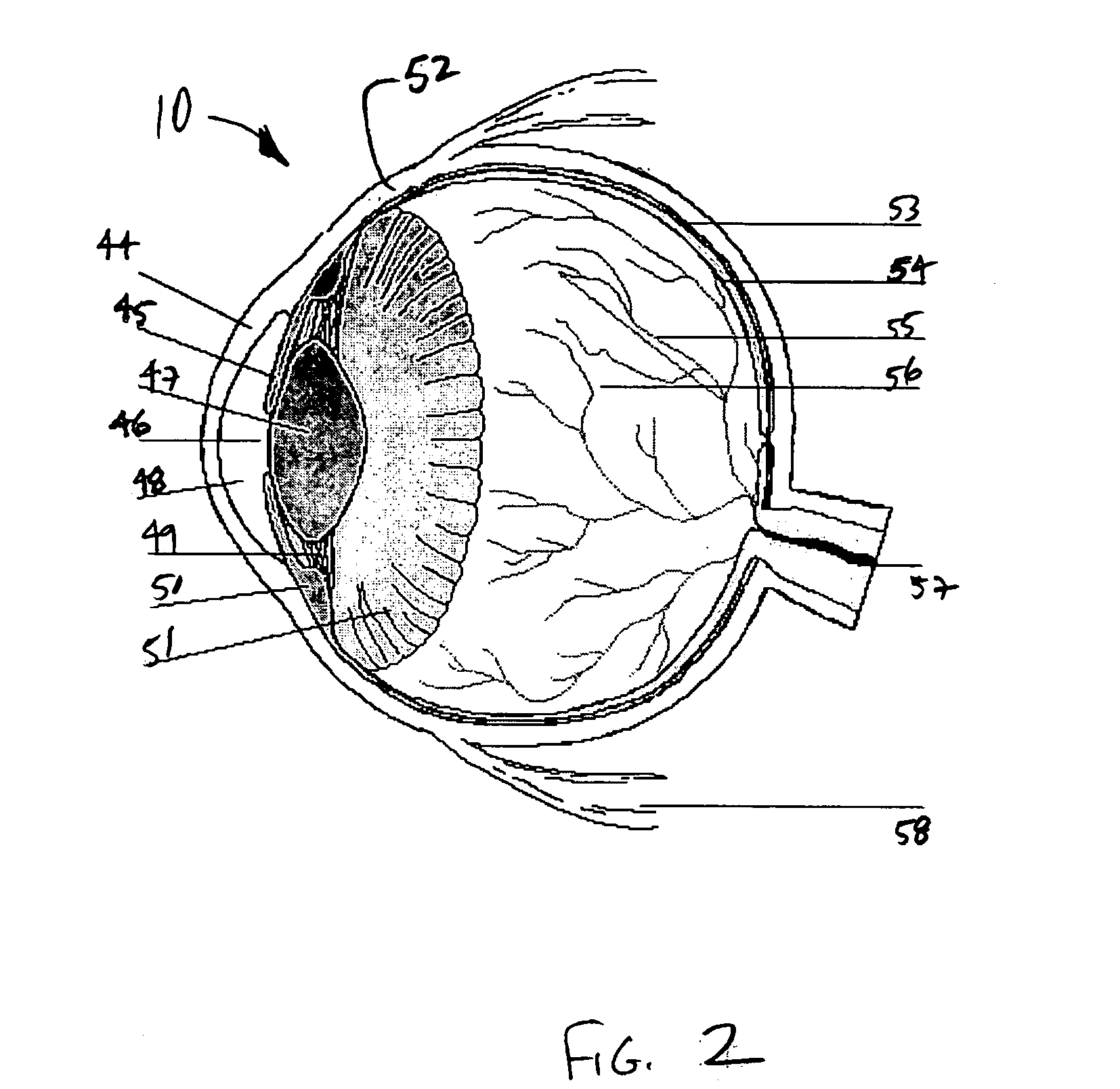 Device for the irradiation of the ciliary body of the eye