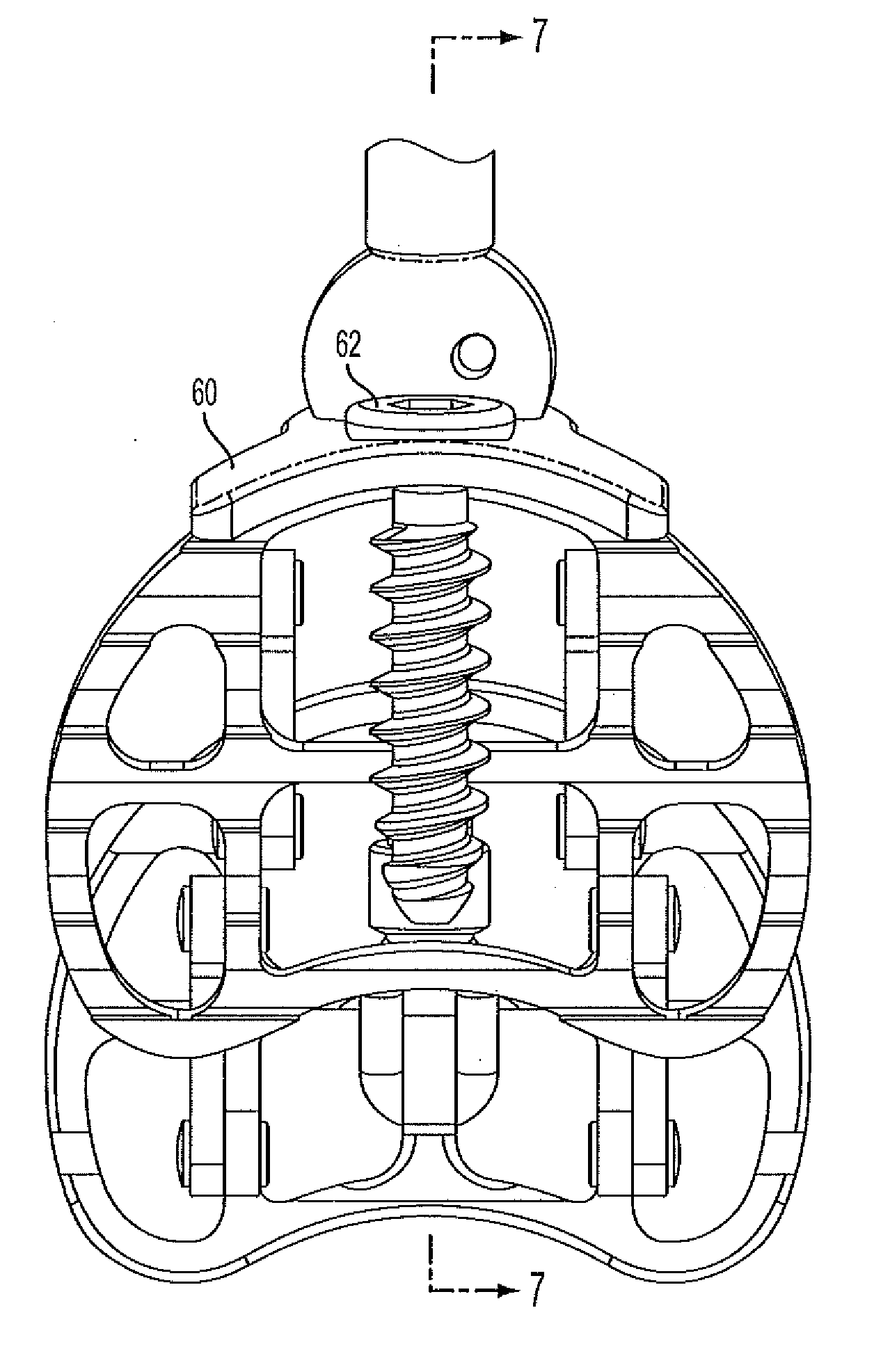 Lumbar jack implant