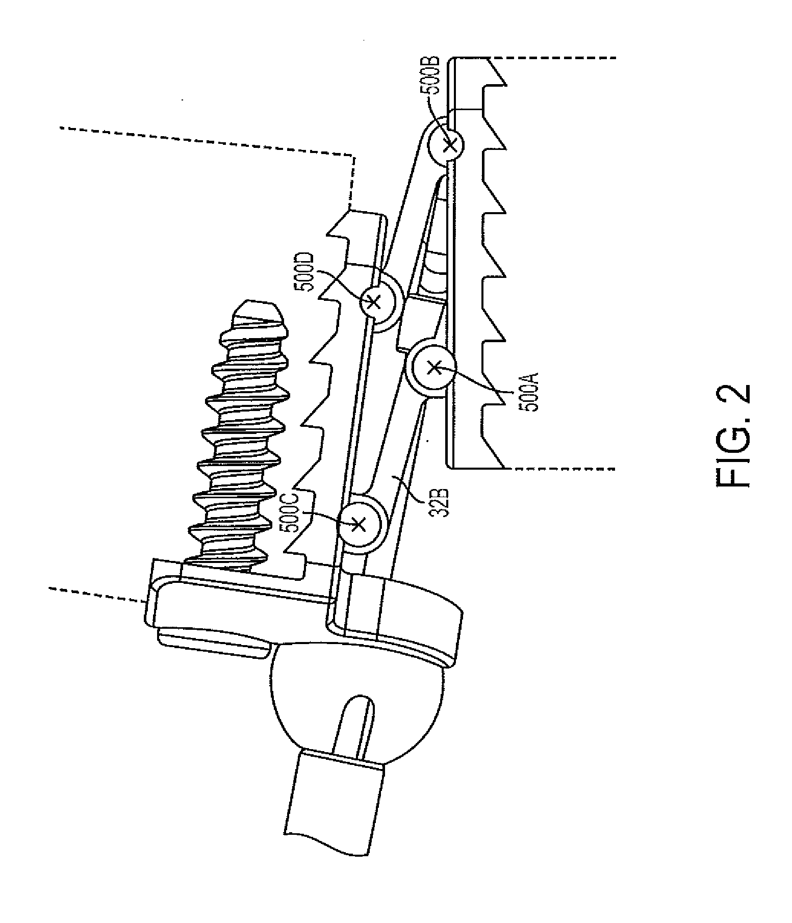 Lumbar jack implant