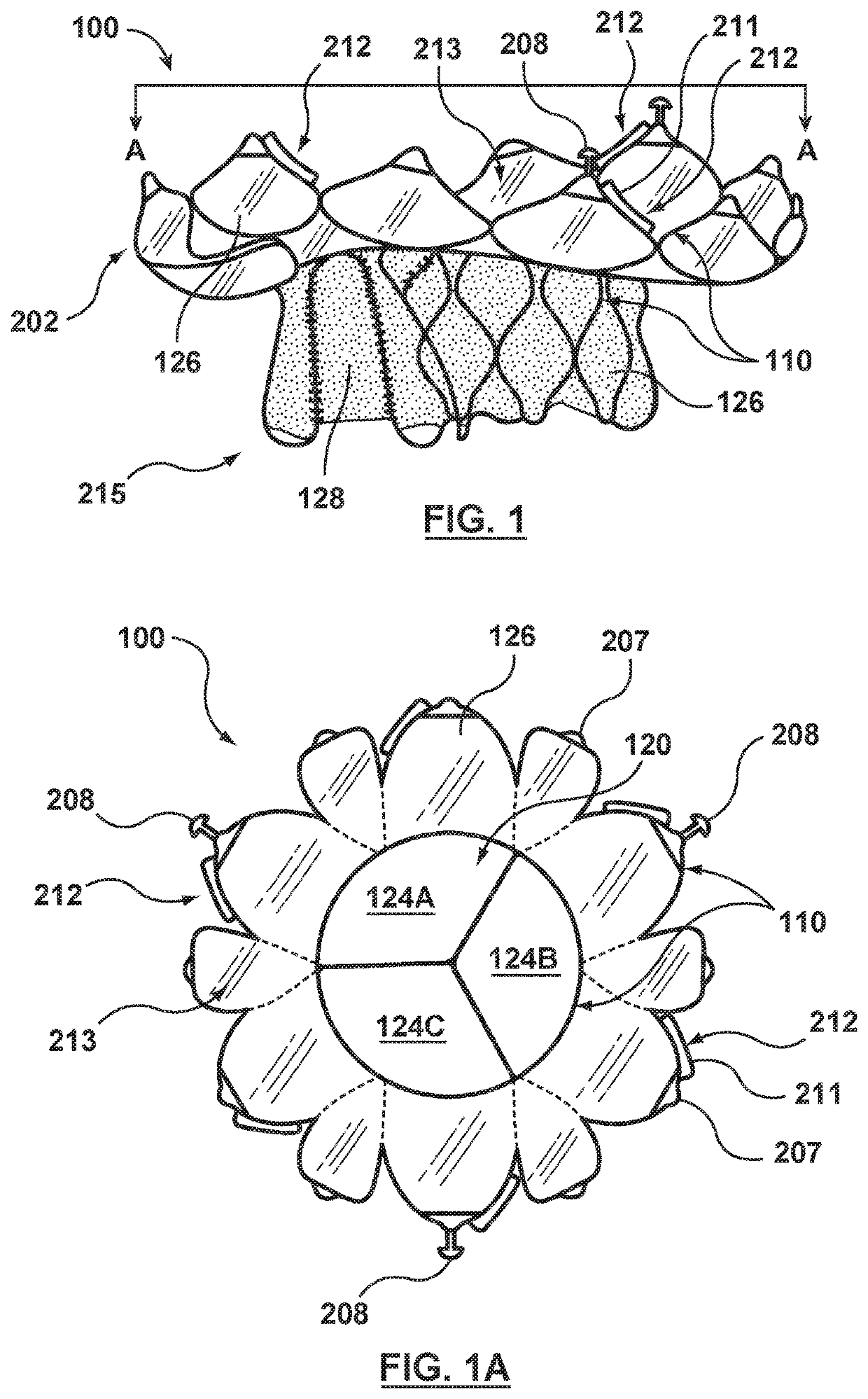 Methods for anchoring a heart valve prosthesis in a transcatheter valve implantation procedure