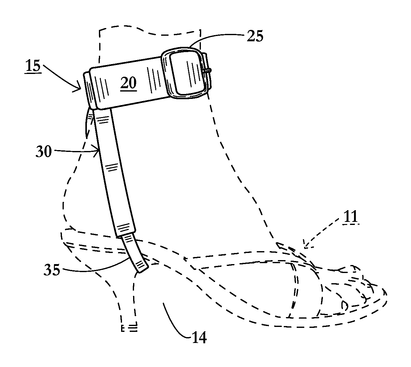Removable ankle strap system for use with high heeled shoes