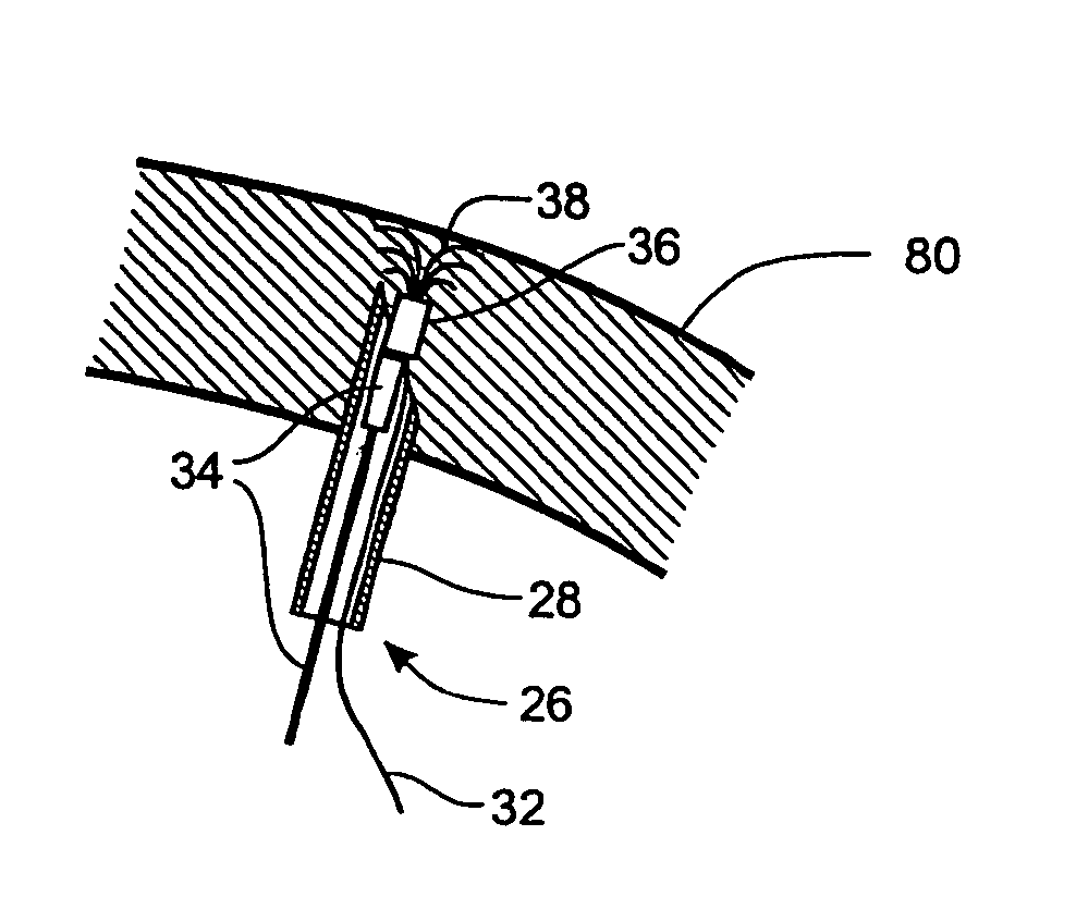 Methods and devices for soft tissue securement