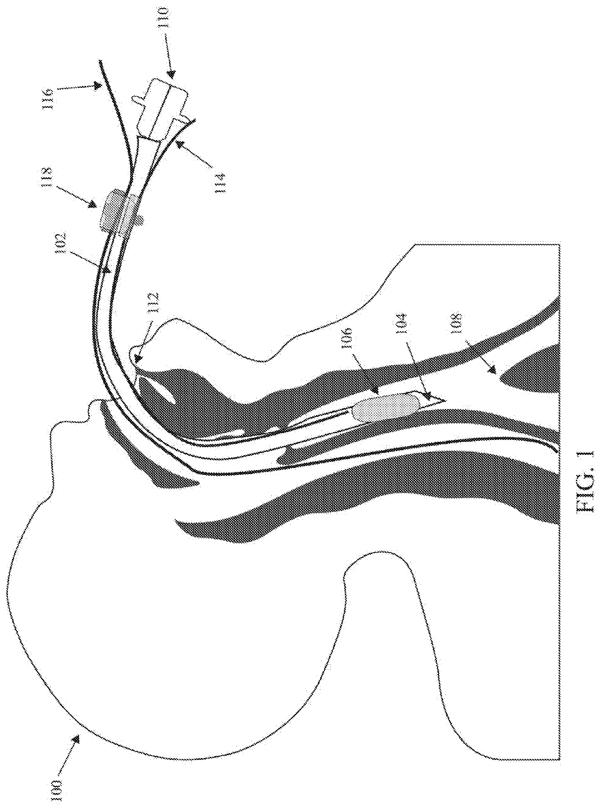 Orally-placed line securement clip