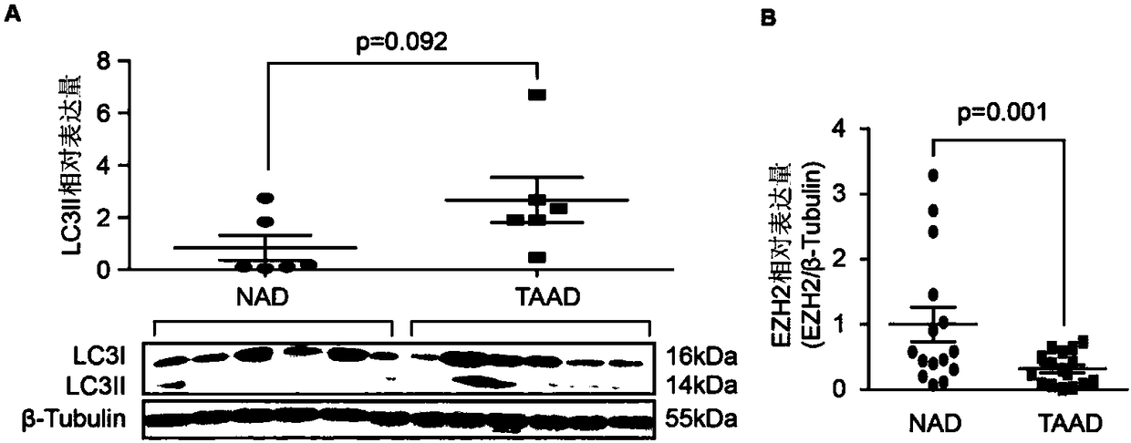 Application of histone methyltransferase EZH2 to preparation of medicinal preparation for preventing or treating aortic diseases