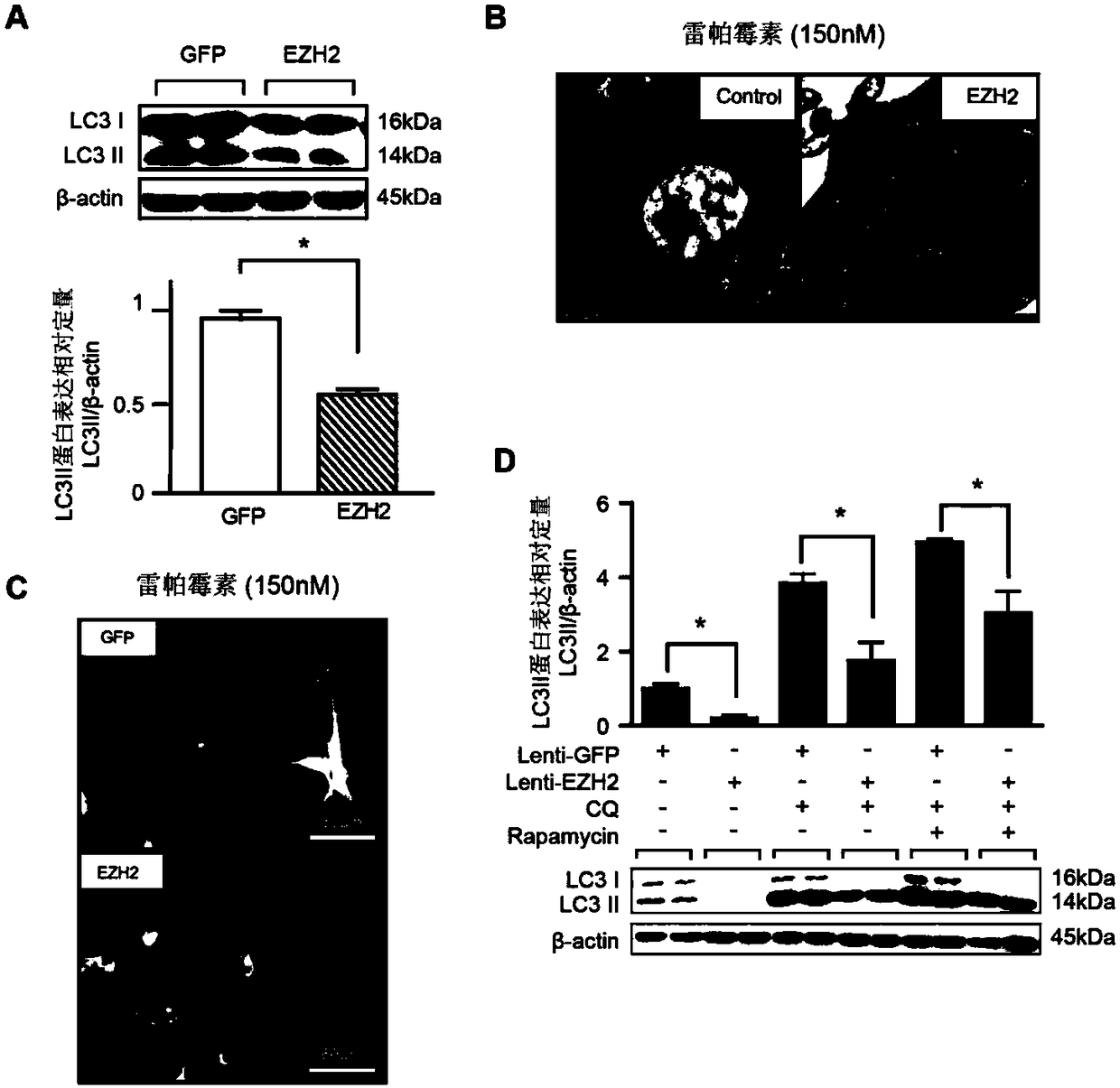 Application of histone methyltransferase EZH2 to preparation of medicinal preparation for preventing or treating aortic diseases
