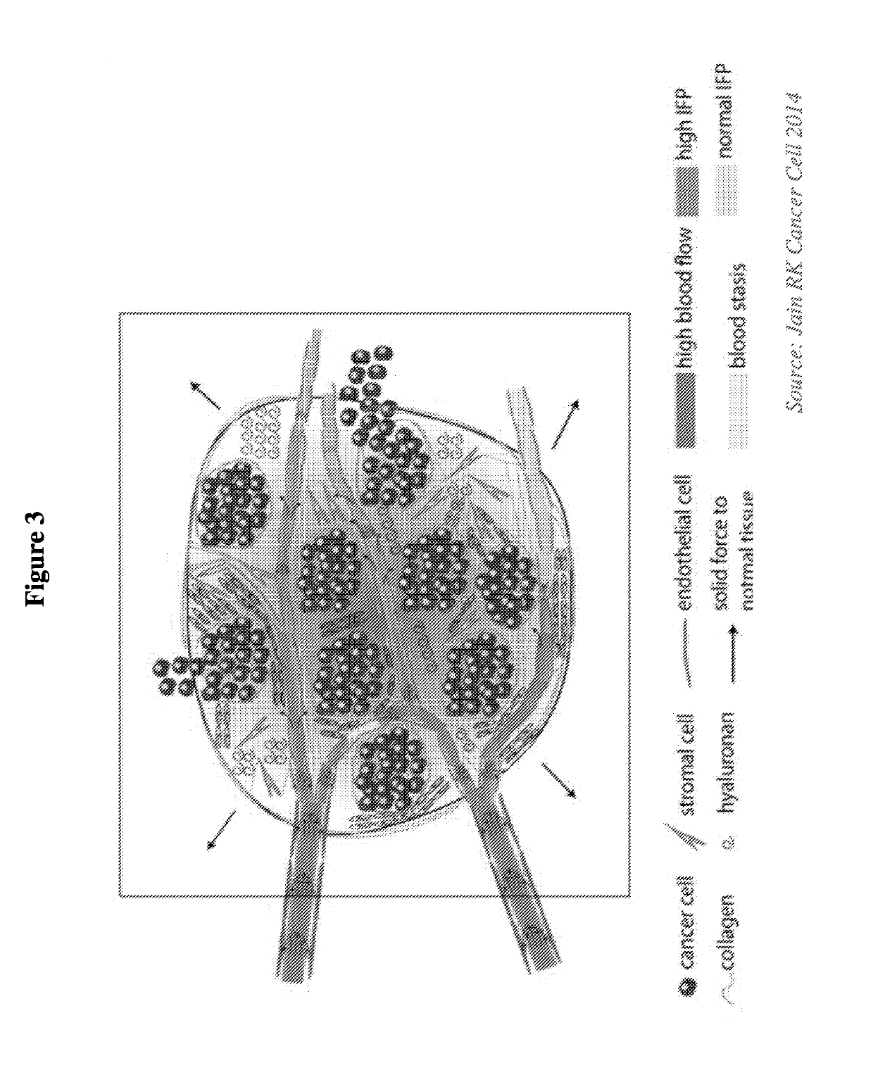 Devices, systems and methods for inhibiting invasion and metasases of cancer