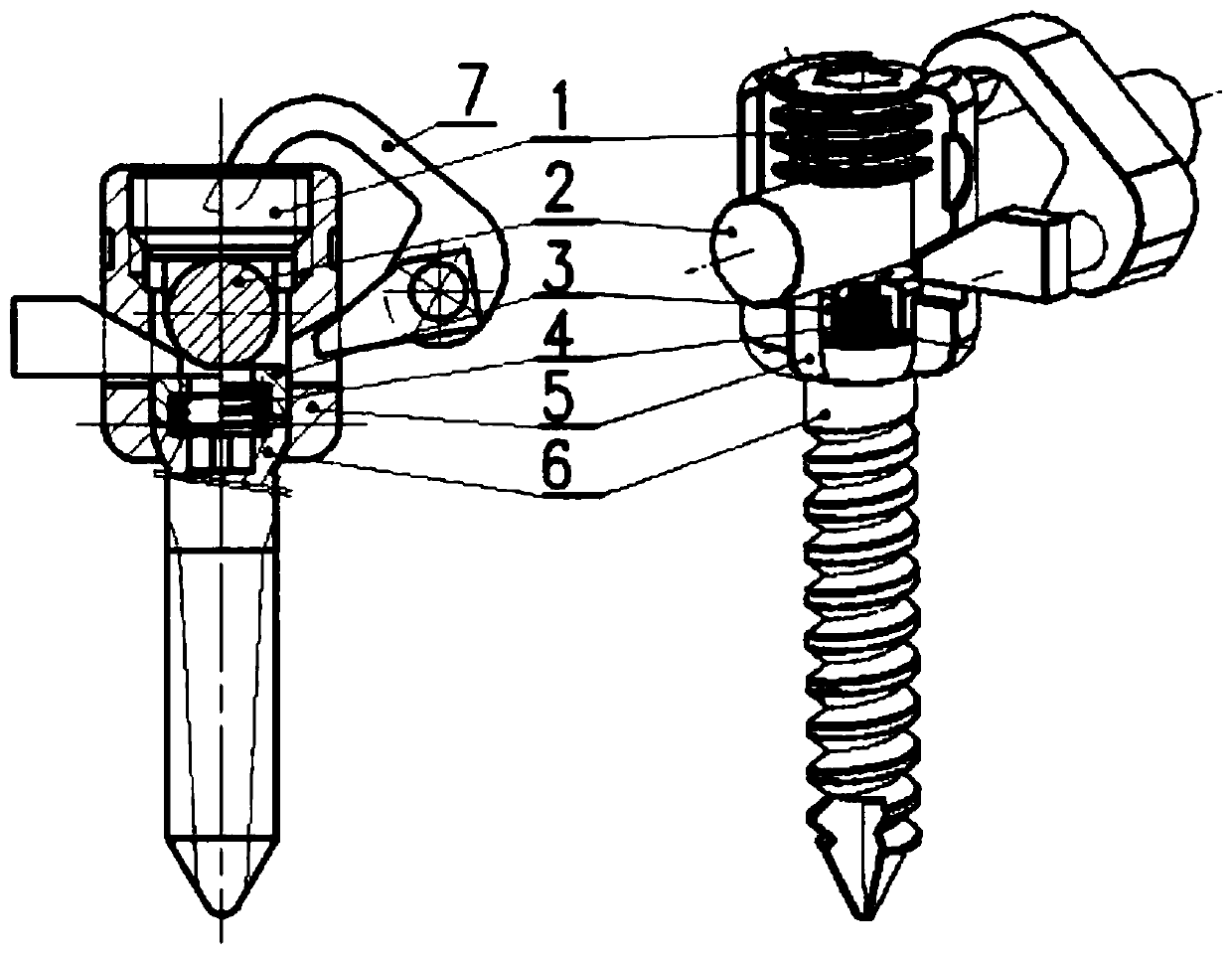 Dynamic pedicle screw neutral pressurization and limiting tool of dynamic pedicle screw