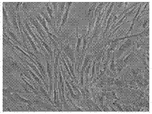 Externally-used traditional Chinese medicine for treating hypertrophic scar and preparation method thereof