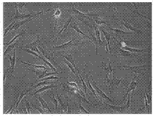 Externally-used traditional Chinese medicine for treating hypertrophic scar and preparation method thereof