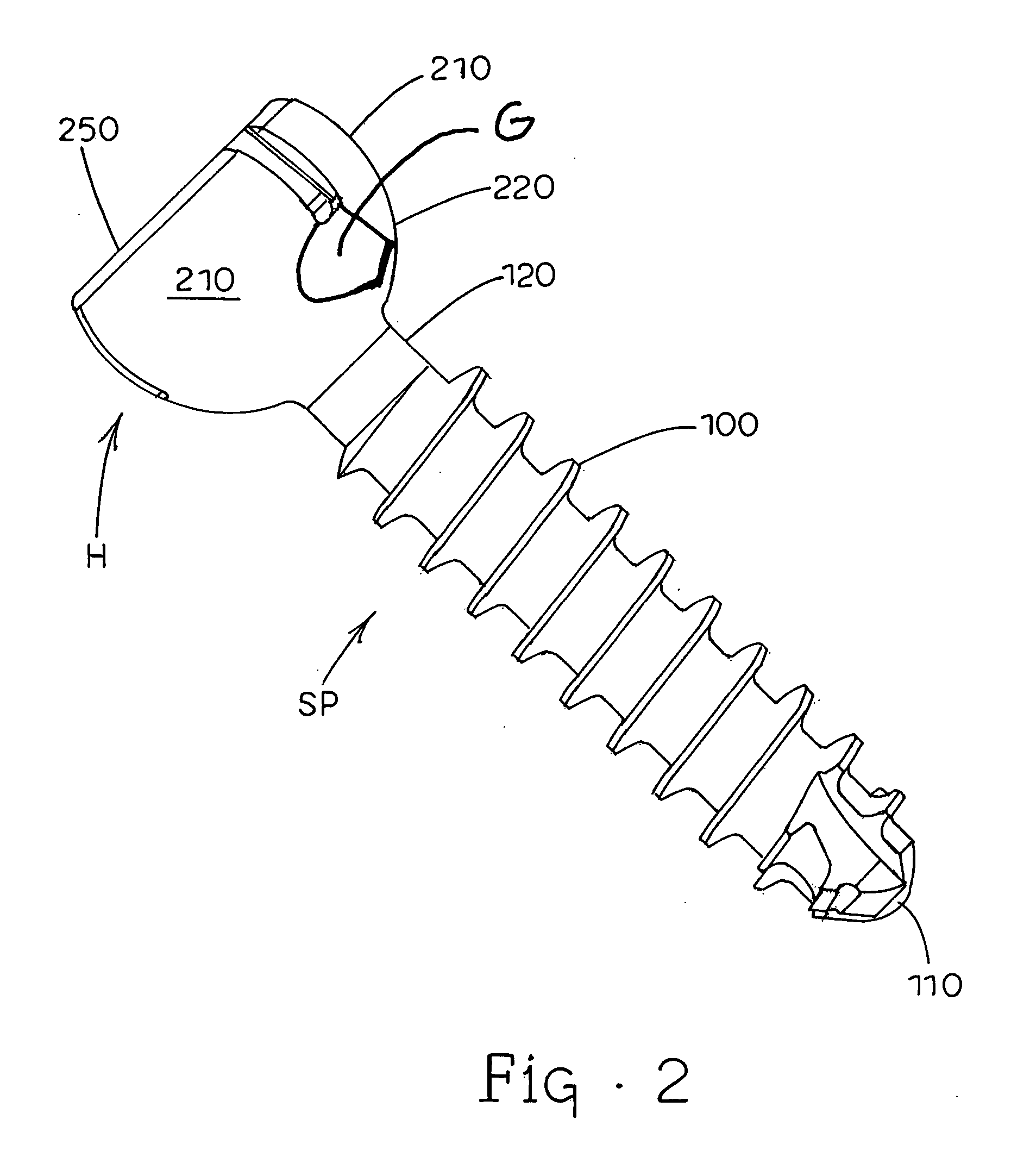 Apparatuses, systems and methods for bone fixation
