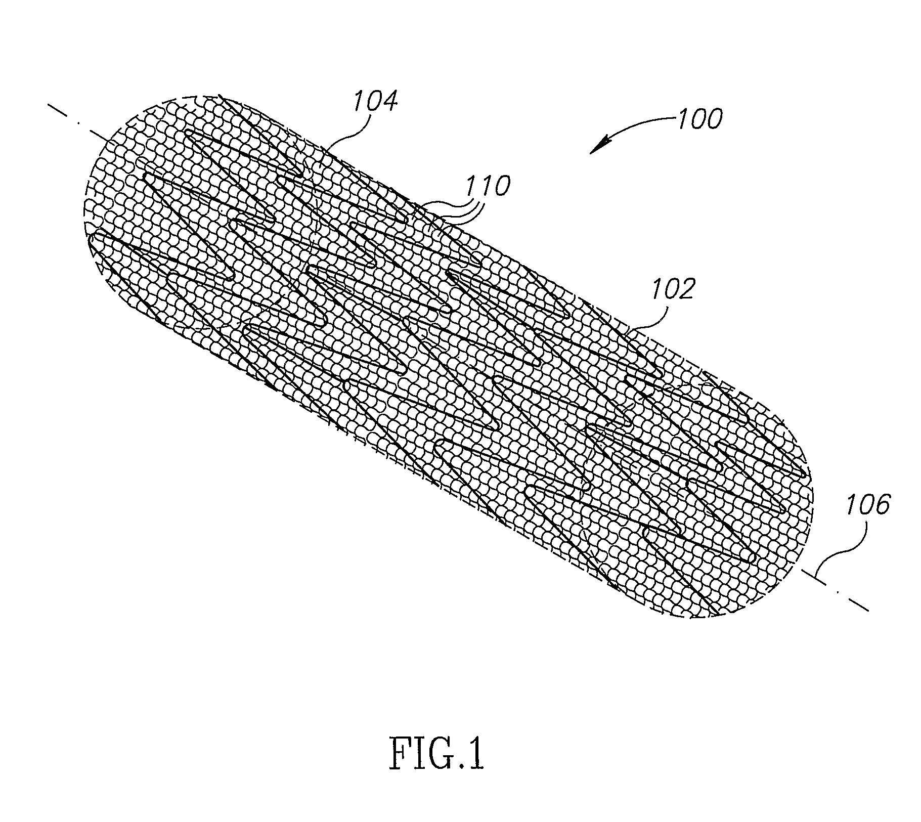 Stent Apparatuses for Treatment Via Body Lumens and Methods of Use