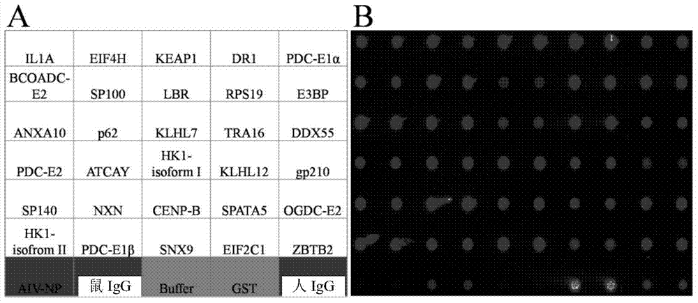 Specific autoantigen of primary biliary cirrhosis (PBC) and application thereof