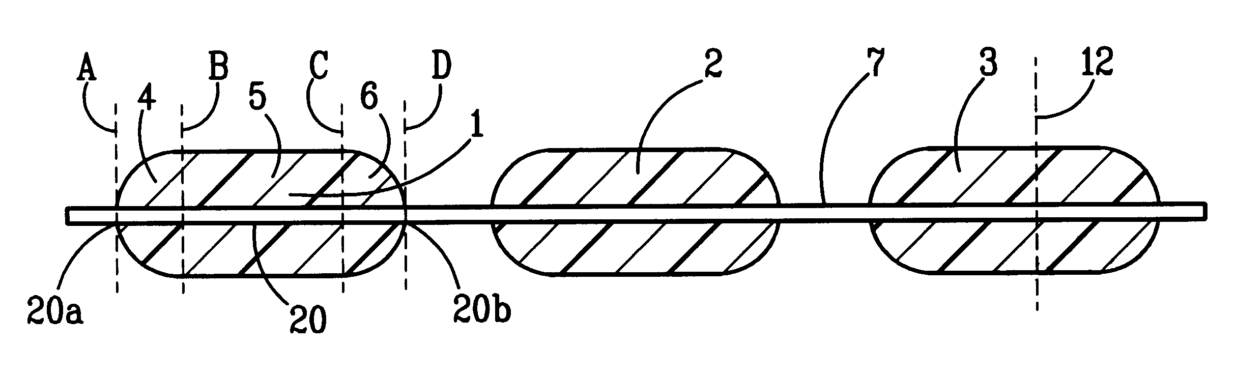 Implantable medicine releasing corpuscles and method of making, implanting and removing the same