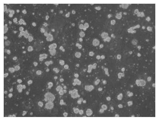 Method for culturing human neural stem cells