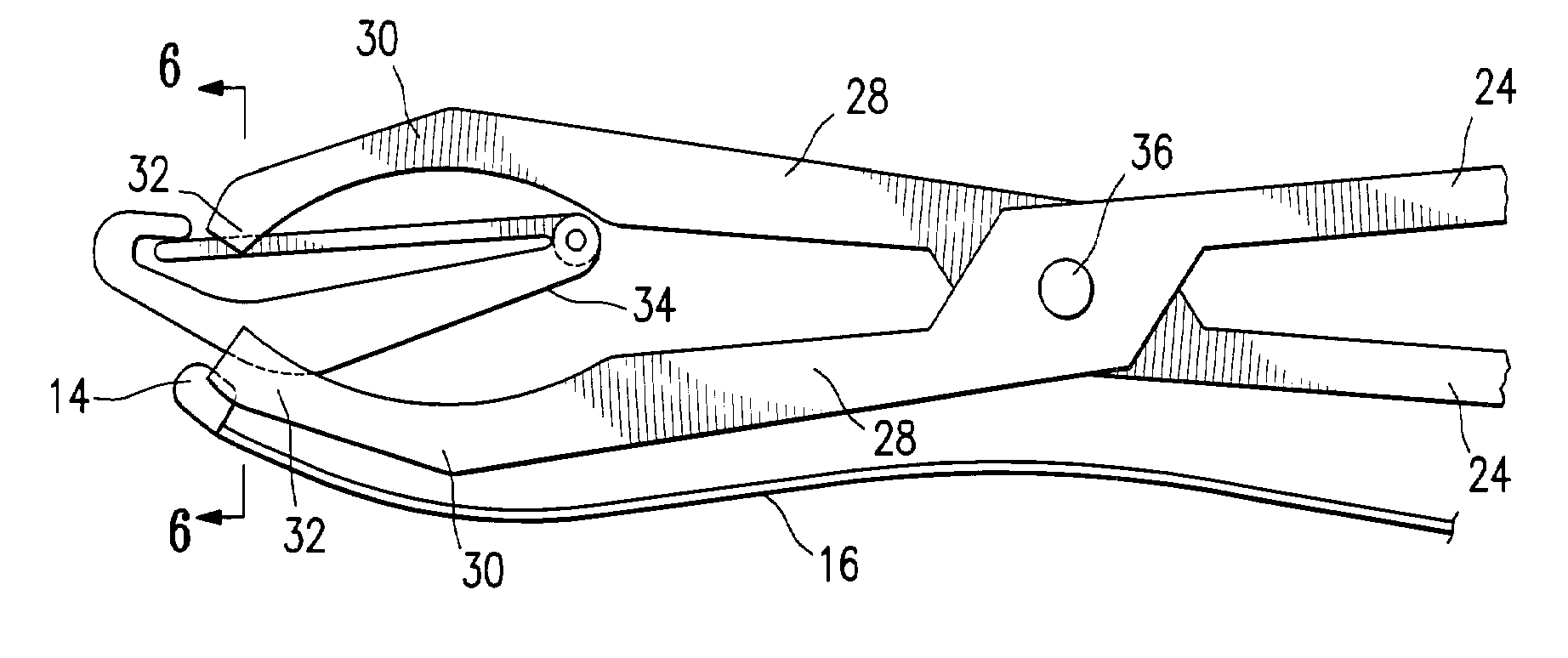 Luminal clip applicator with sensor and methods for occluding body lumens
