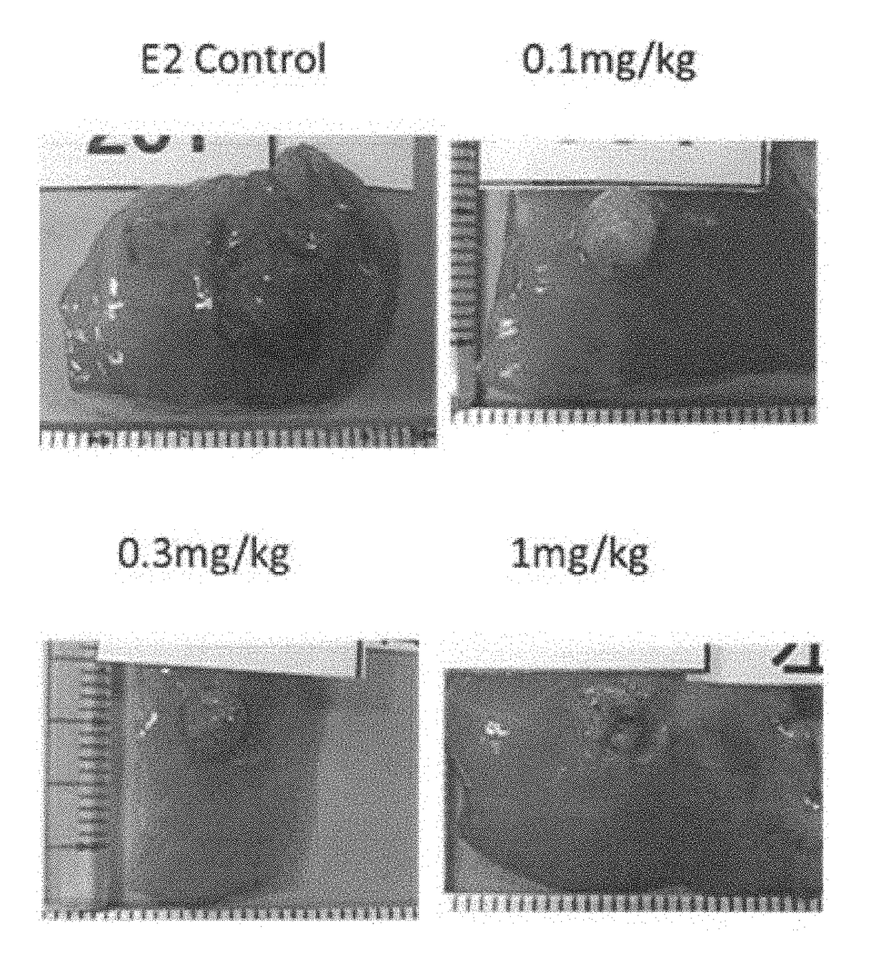 ESTROGEN RECEPTOR Beta PARTIAL AGONIST HAVING ESTROGEN RECEPTOR Alpha INHIBITORY EFFECT, AND GYNECOLOGICAL DISEASE THERAPEUTIC AGENT USING SAME